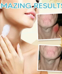 Alternative view of Lymphedem Detoxification Cream