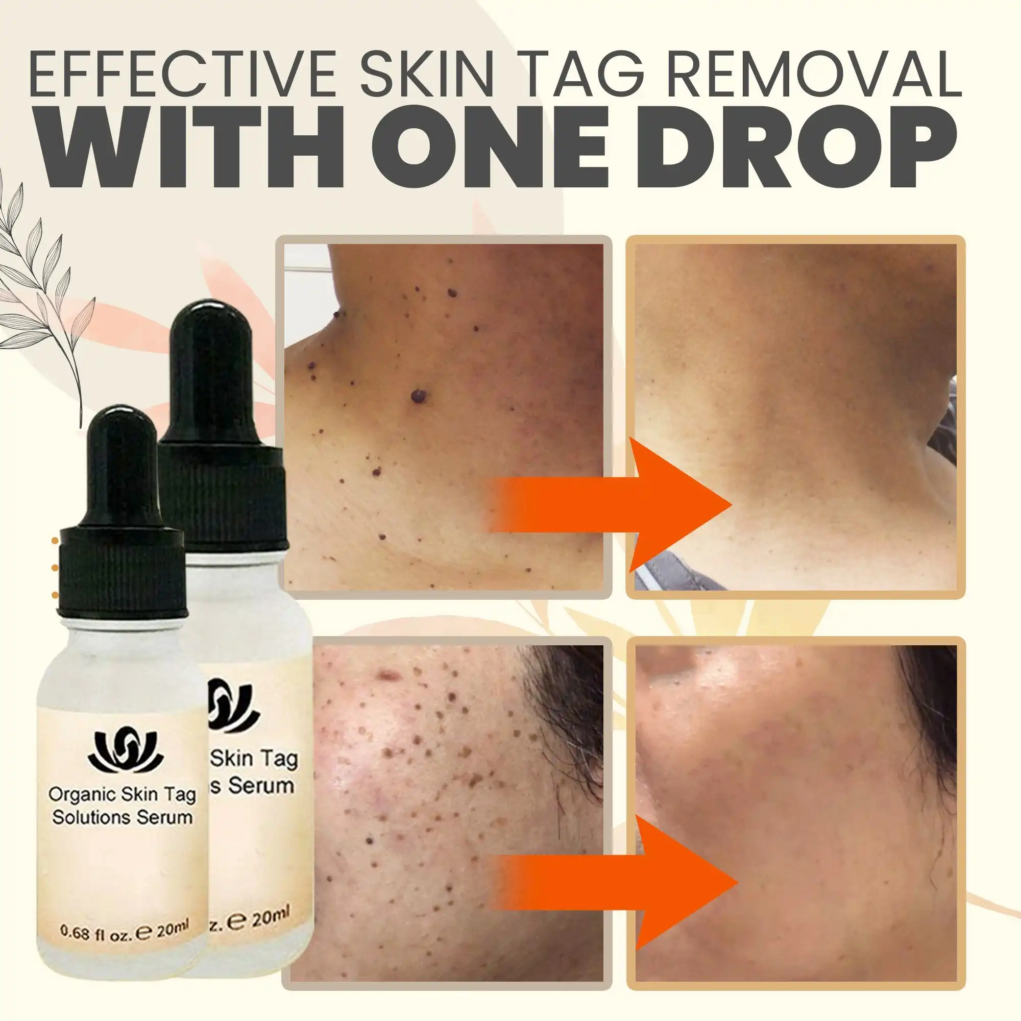 SpotOut Organic Purifying Serum - Image 4