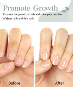 Alternative view of Herbal Nail Treatments Essential Oil