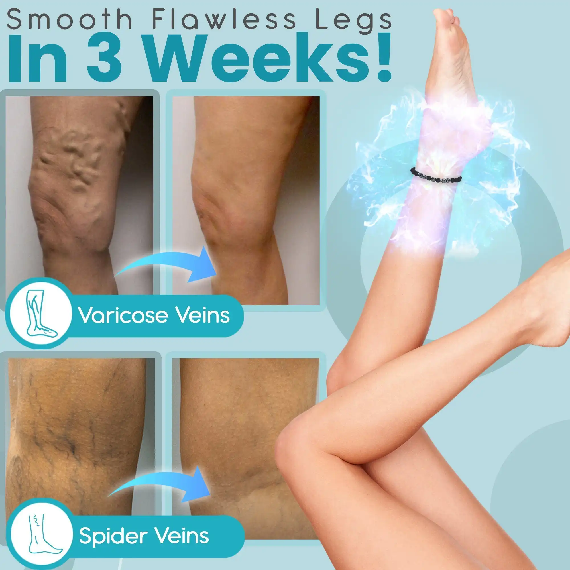Anti Varicose And Swelling Magnetotherapy Anklet - Image 3