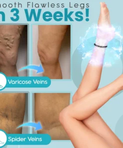 Alternative view of Anti Varicose And Swelling Magnetotherapy Anklet