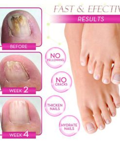 Alternative view of Ginger Health Toe Repair Treatment Gel