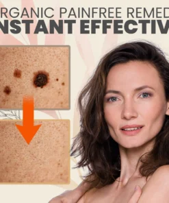 Alternative view of SpotOut Organic Purifying Serum