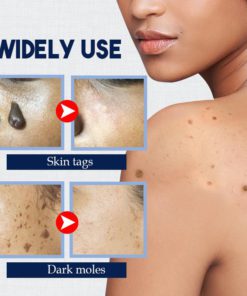 Alternative view of Fall Off SkinTag RemoverCream