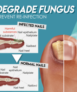Alternative view of Dotorus Fungus Nail Repair Gel
