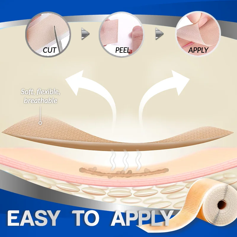 Professional Scar Removal Silicone Tape - Image 3