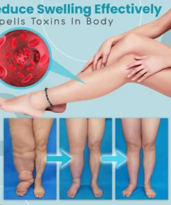 Alternative view of Anti Varicose And Swelling Magnetotherapy Anklet