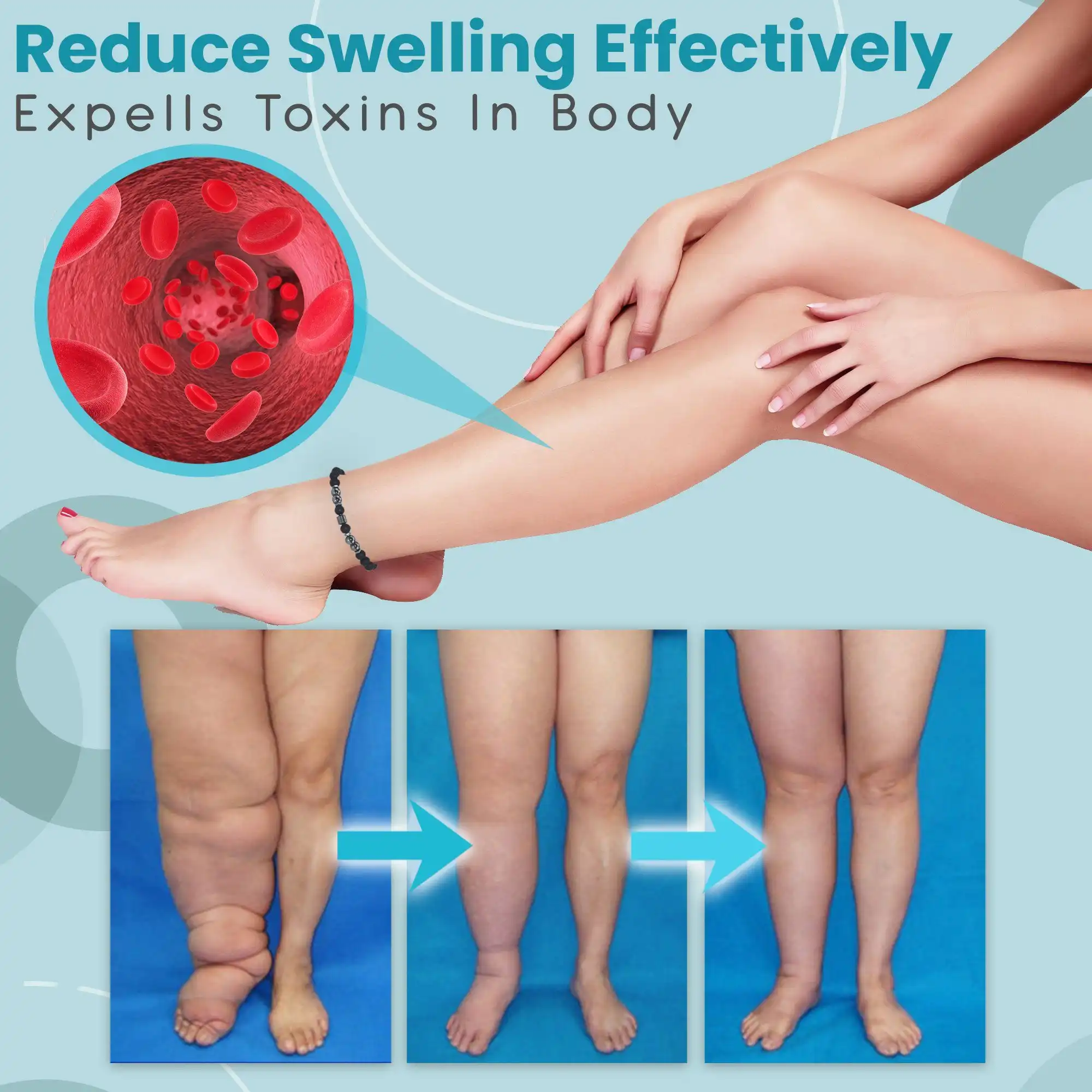 Anti Varicose And Swelling Magnetotherapy Anklet - Image 2