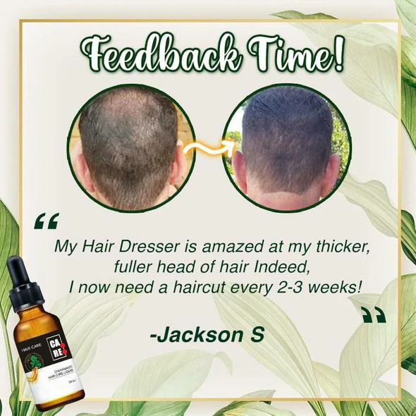 Car Carbon Fiber Fire-Breathing Tail Throat - Image 5