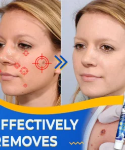 Instant Purifying Blemish Corrector