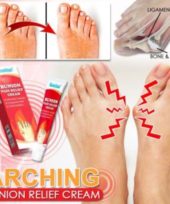 Arching Bunion Relief Cream