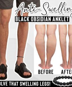 Anti-Swelling Black Obsidian Anklet