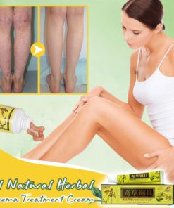 All-Natural Herbal EczemaTreatment Cream