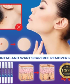 MolesAndSkinTag Herbal RemoverPen