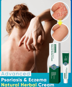 Ultimate Psoriasis & Eczema Natural Herbal Cream