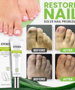 Ant-Fungal Nail Treatment Gel