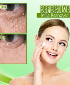 Alternative view of Organic EyeMilia RemoverCream