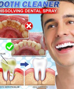 CalculusFree Dissolving Dental Spray