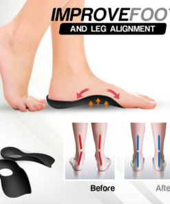 Alternative view of Flat Foot Orthopedic Health Insoles