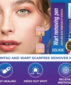 Alternative view of MolesAndSkinTag Herbal RemoverPen