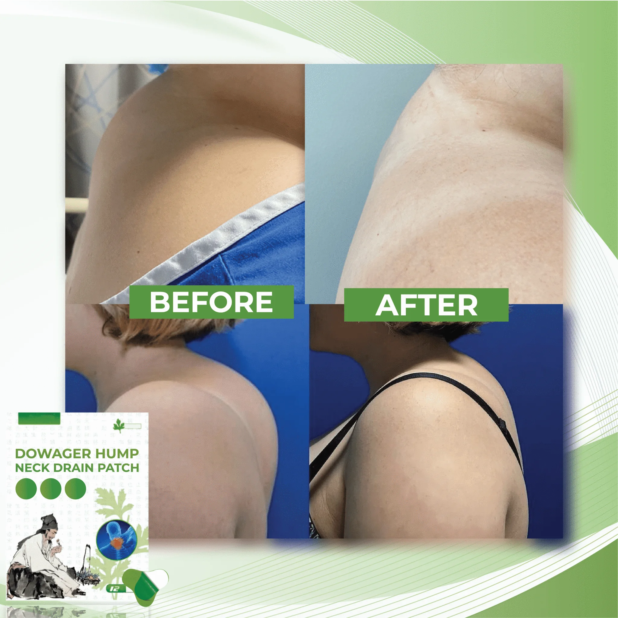 Organic NeckDrain DowagerHump Patch - Image 7