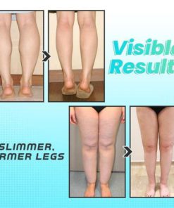 Alternative view of Acupuncture Feet Massager