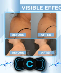 EMS DowagerHump DrainagePad