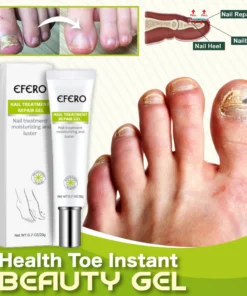 Toe Be Happy Gel