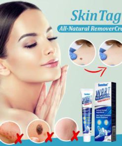 SKINTAG ALL-NATURAL REMOVERCREAM