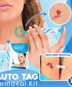 Auto Tag Rapid Removal Kit