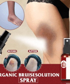 ORGANIC BRUISESOLUTION SPRAY