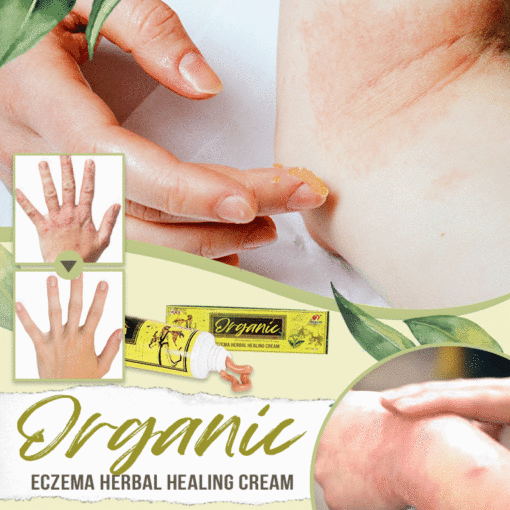 FNB Organic Eczema Herbal Natural Healing Cream