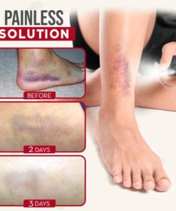 Alternative view of Herbal BruiseFixer Spray