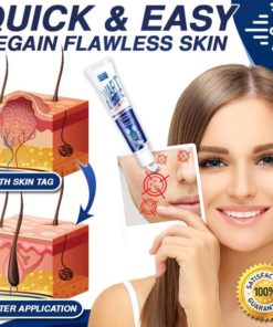 Alternative view of Skin Marks Remover