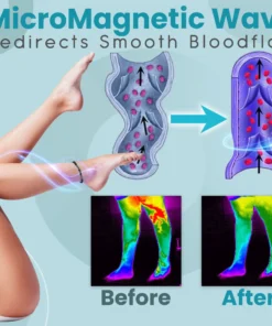 Alternative view of Vein Care Mangnetotherapy Anklet