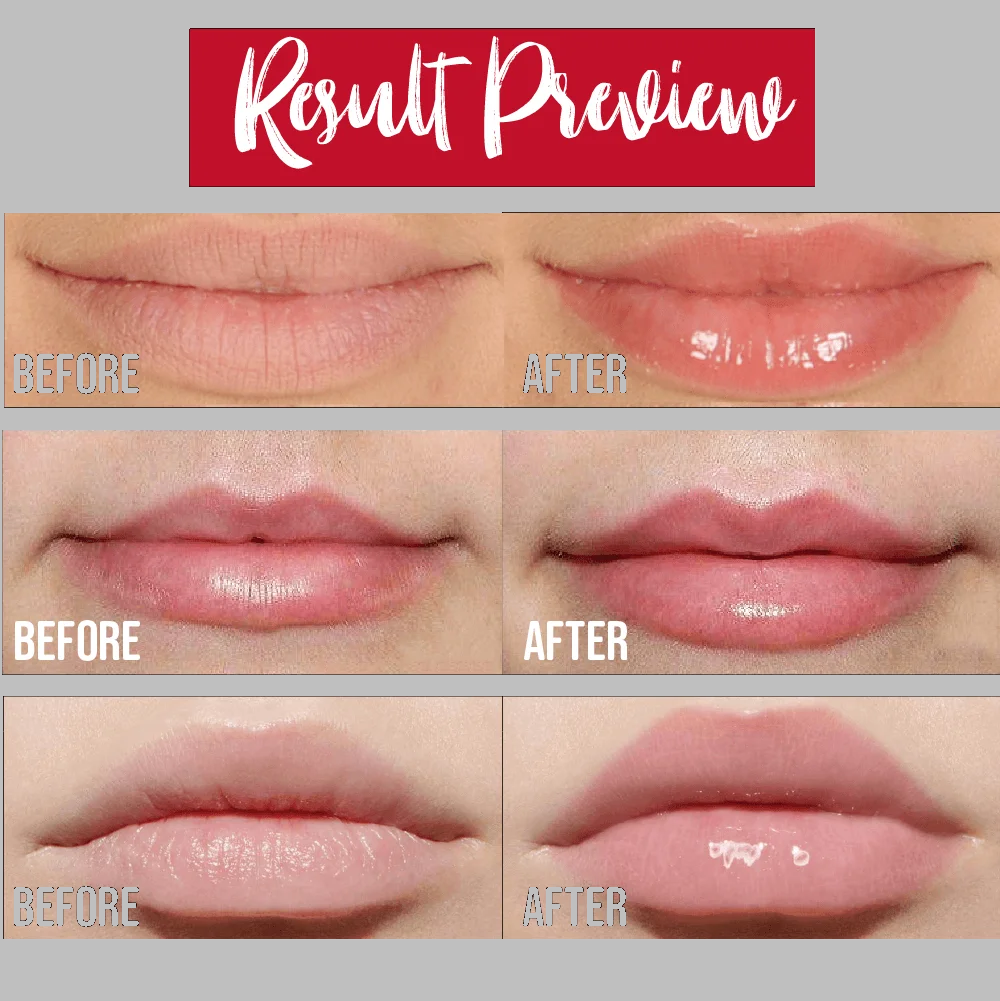 💋5 Mins Extreme Lip Plumper - Image 3