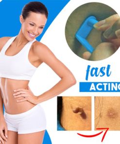 Alternative view of INSTANT SKINTAG REMOVER KIT