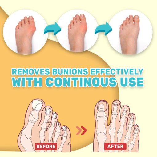 DeltaNatural Bunion Toe Stiffness Relief Cream