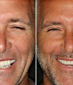 Alternative view of OKORO Men’s Intensive Firming Eye Cream