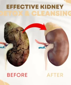 Alternative view of NatureCleanse Kidney Support Herbal Effervescent Tablets