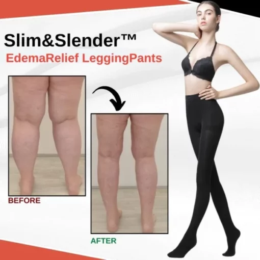 Slim&Slender EdemaRelief LeggingPants