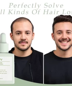 Alternative view of Divv Scalp Serum – Repair & Regrow