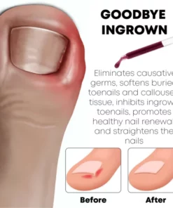 Alternative view of PediPerfect AntiParonychia Relief Oil