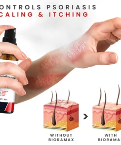 Alternative view of BIORAMAX Essence PsoriaRescue Treatment Spray