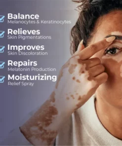 Alternative view of MEDix Vitiligo Relief Spray
