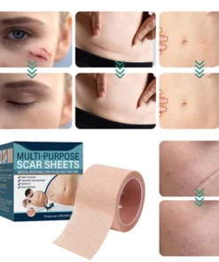 Alternative view of ELAIMEI Medical Soft Silicone Gel Tape for Scar Removal