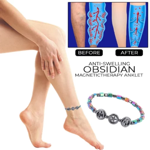 AntiSwelling Obsidian MagneticTherapy Anklet