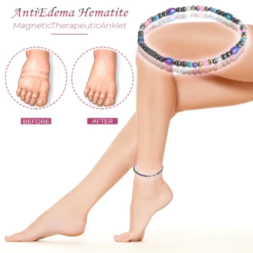 AntiEdema Hematite MagneticTherapeuticAnklet