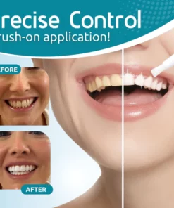 Alternative view of BrightSmile Teeth Whitening Essence