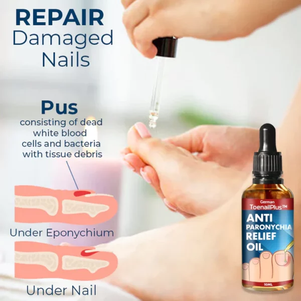 German ToenailPlus Anti Paronychia Relief Oil